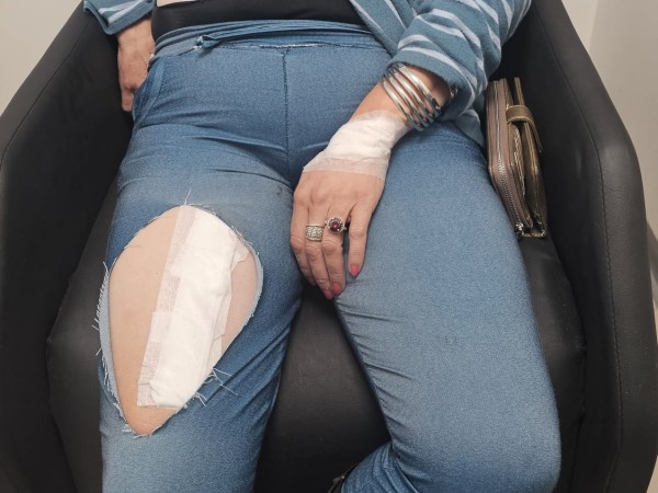 “Si me sacaban del auto me iban a violar y me iban a matar”: el relato de una mujer víctima de rapiña e intento de violación