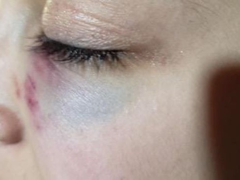 Violento delincuente entró a una casa y agredió a sus propietarias: a una de ellas la ató con una sábana e intentó abusar de ella y a la otra le pegó con una escoba